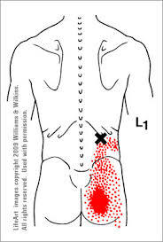 トリガー10腰腸肋筋1.jpg
